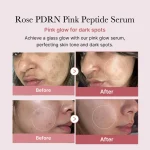 Medicube PDRN Pink Peptide Serum – Sérum Raffermissant & Éclat | Skincare Coréen Anti-Âge – Image 2
