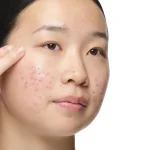 The Ordinary Alpha Arbutin 2% + HA – Sérum Anti-Taches & Éclat – Image 2